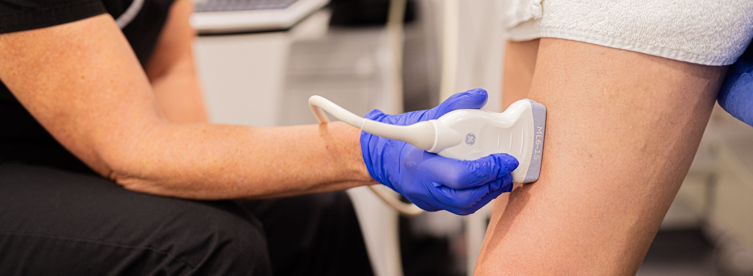 Picture of a clinician using an ultrasound to do an Endovenous Ablation (EVA) on a patient