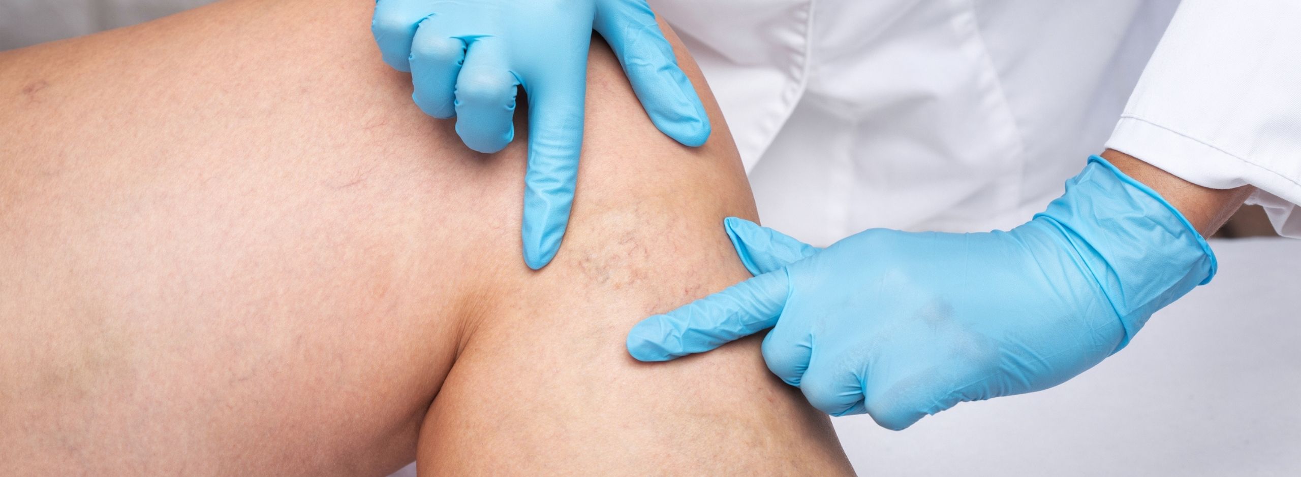 A patient having a free veins assessment with a doctor