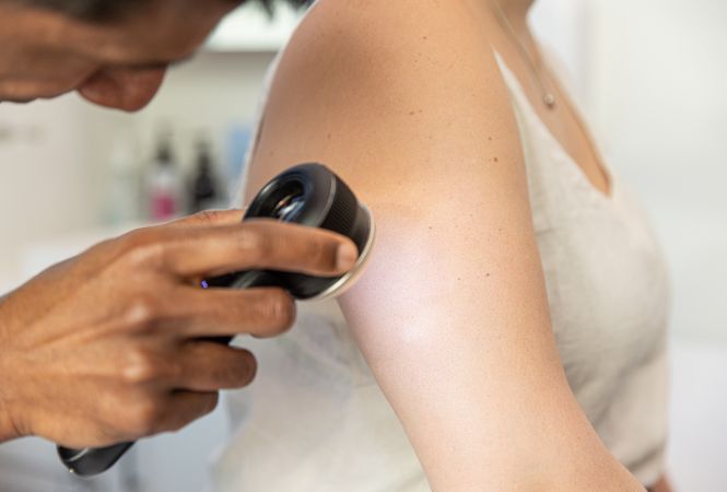 Thread Lift | Skin Institute